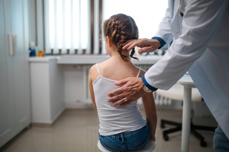 Escoliose em crianças: como identificar e tratar com segurança desde cedo